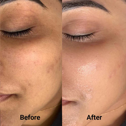 Advanced PDRN Skin Renewal Cream
